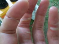 Name: 100_6463.JPG
Views: 240
Size: 29.7 KB
Description: my messed up hand :)