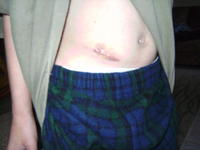 Name: Kams scar.JPG
Views: 845
Size: 44.6 KB
Description: 