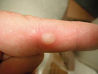 Name: DSCF4427.jpg
Views: 189
Size: 102.1 KB
Description: The hazards of a hot glue gun.